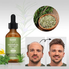 GrowGleam™️ Rosemary Hair Growth Serum Oil (Pack of 2)